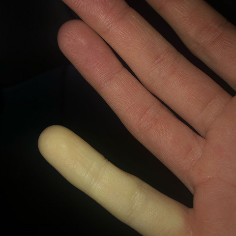 Mein Finger  - (Gesundheit und Medizin, Gesundheit, Finger)