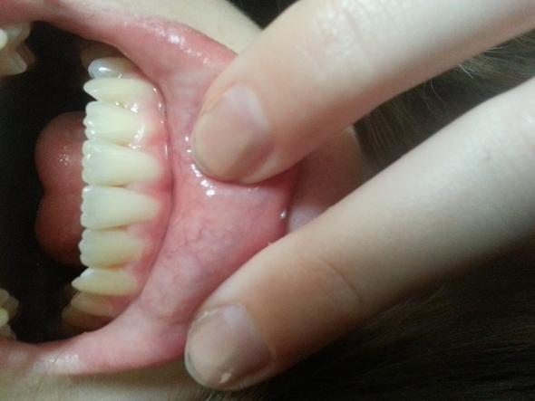 Meine Zähne - (Arzt, Zähne, Zahnarzt)