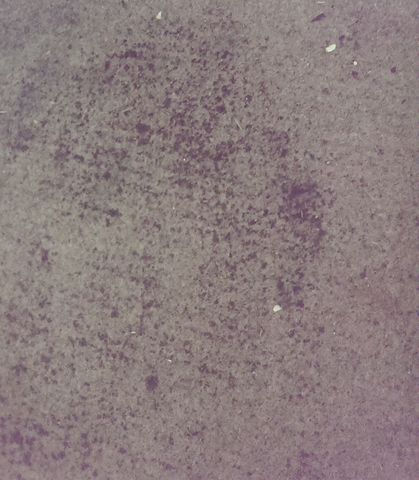 Ist Das Schimmel Am Teppich Was Konnte Es Sonst Sein Gesundheit Schmutz Sauberung Ist Das Schimmel Am Teppich Was Konnte Es Sonst Sein Gesundheit Schmutz Sauberung