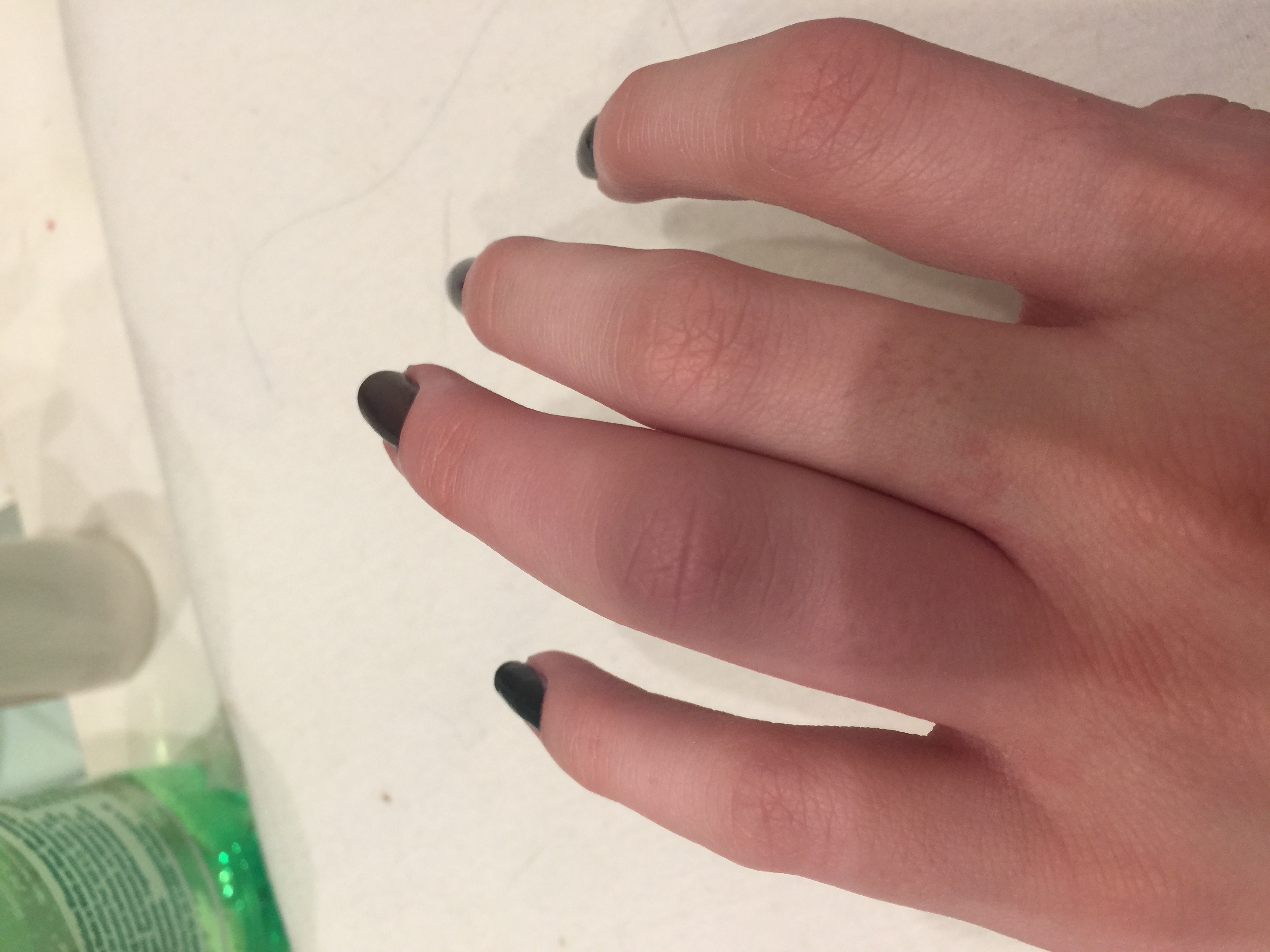 Ist das schlimm wenn man mit dem Hammer auf den Finger haut? (Schmerzen, Bruch, Prellung)