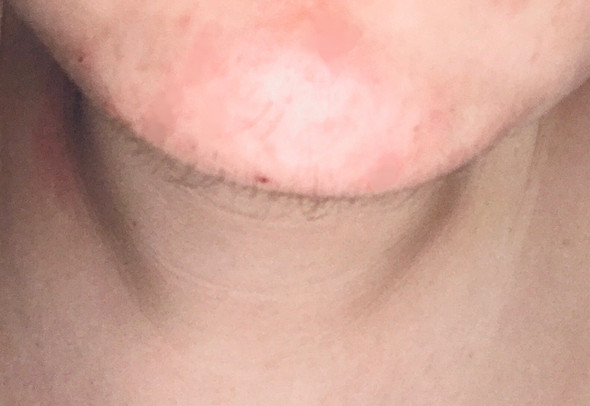 ist das schon bartwuchs haare manner