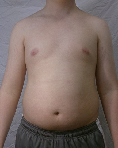 Ist Das Schon Ein Dicker Bauch Gesundheit Sport Fitness Ist Das Schon Ein Dicker Bauch Gesundheit Sport Fitness