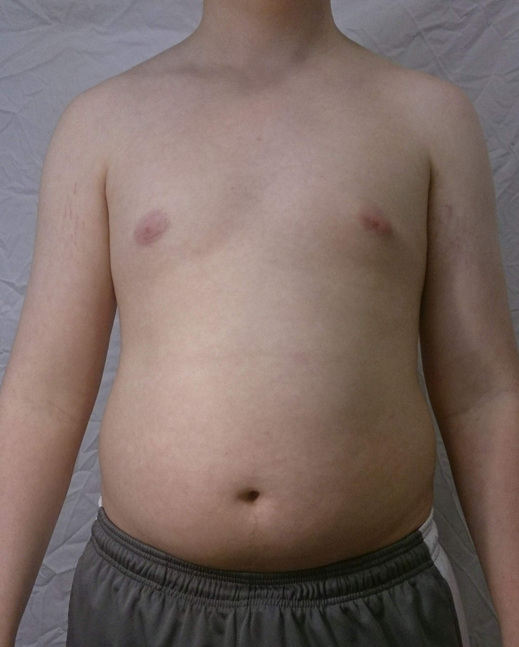 Ist das schon ein dicker Bauch!? (Gesundheit, Sport, Fitness) Ist das schon ein dicker Bauch!? (Gesundheit, Sport, Fitness)