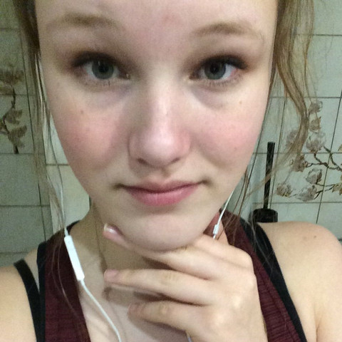 Nicht wundern, Foto nach Sport :D - (Haut, Rosacea)