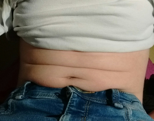 Bauch haut am Kleine Blutschwämme: