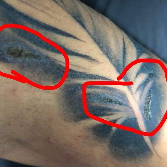 Ist das Tattoo entzündet. Wenn ja, wie behandelt man diese? (Gesundheit