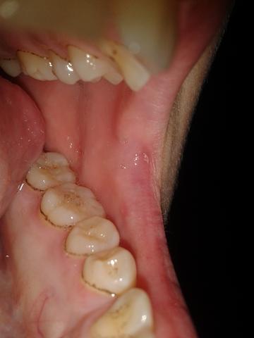 Zähne - (Zähne, Zahnarzt, Zahnmedizin)