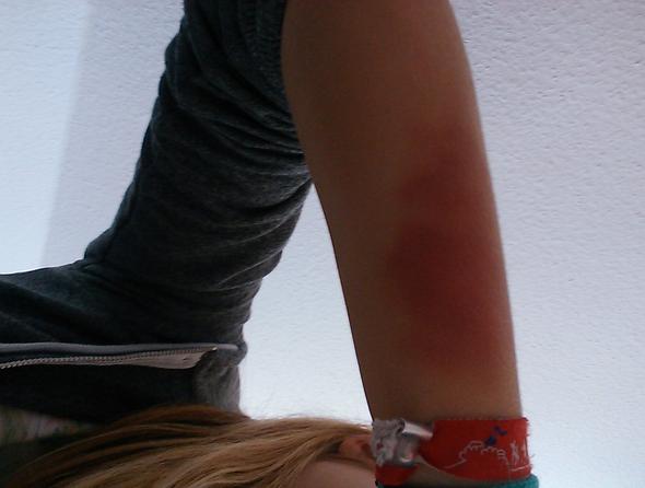 das ist mein arm  - (Gesundheit, Arm)