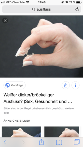 Klumpiger Ausfluss Schwangerschaft Klumpiger Ausfluss Schwangerschaft