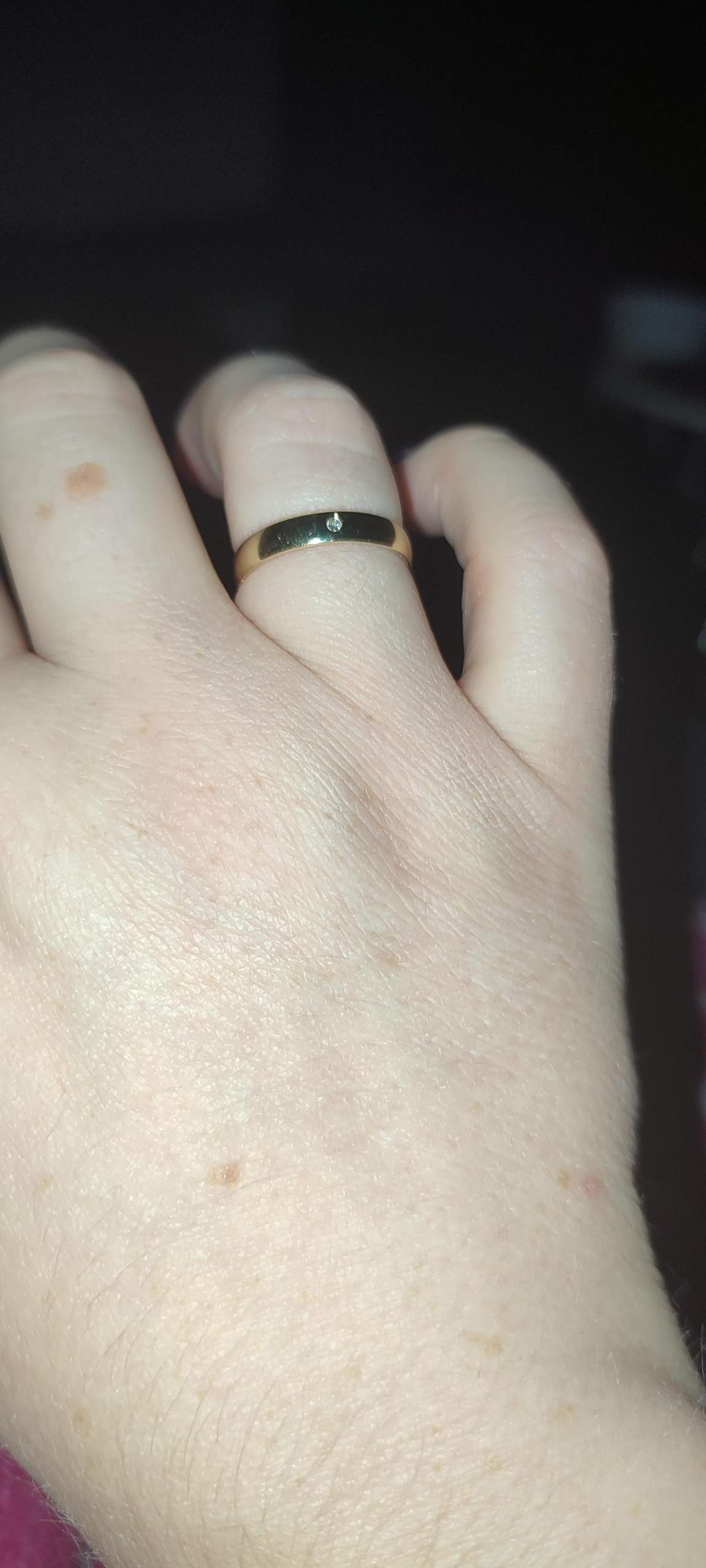 Ist der Ehering zu eng? (Frauen, Gold, Ring)