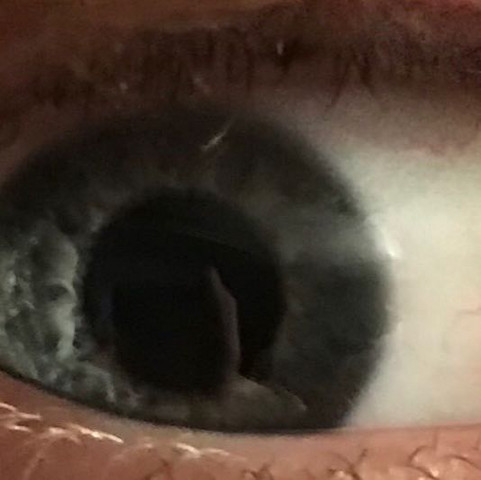 Mein Auge - (Gesundheit, Arzt, Augenarzt)