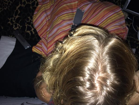 Ist Der Scheitel Normal Oder Habe Ich Haarausfall Haare
