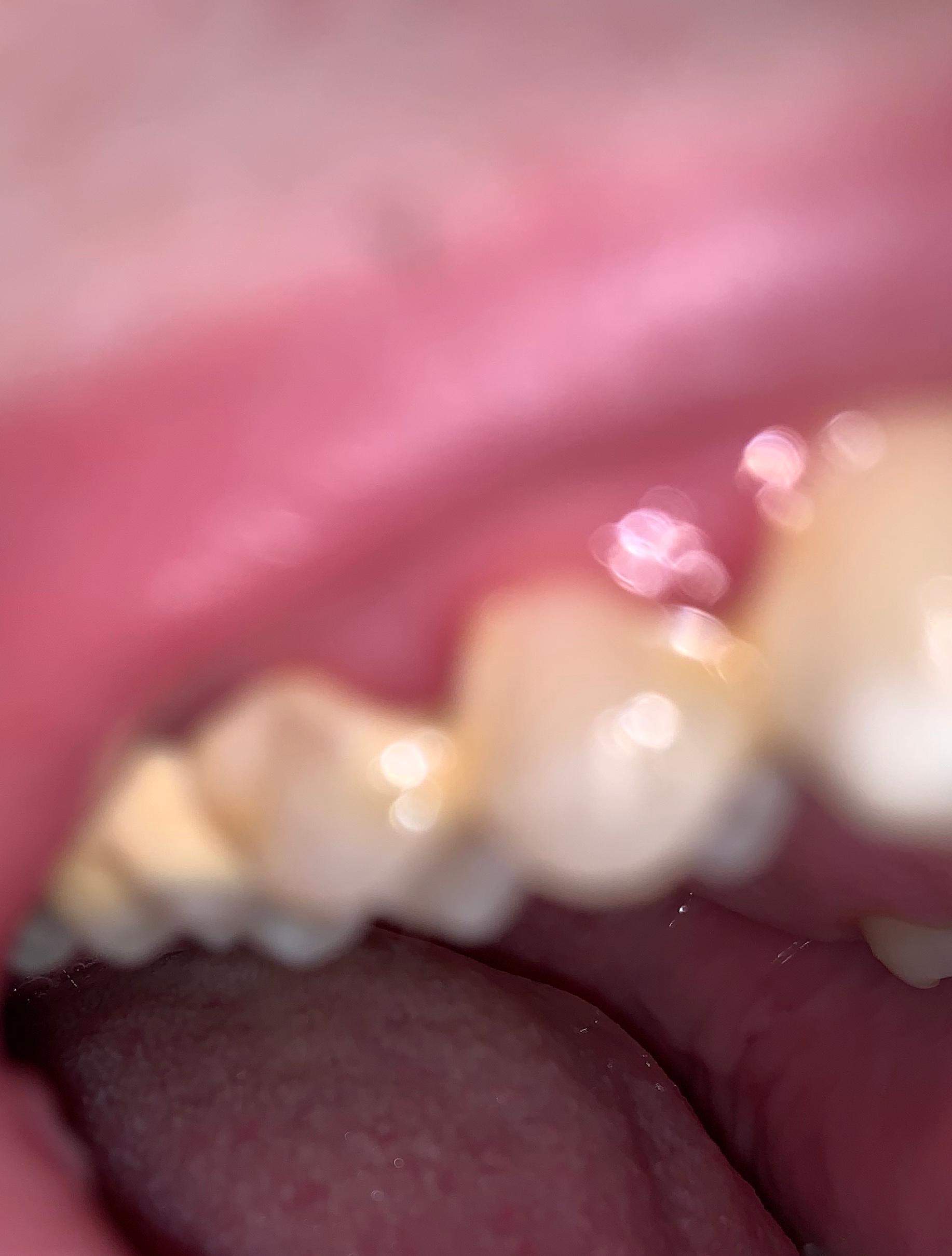 Pocht zahnfleisch pulsierende Zahnschmerzen