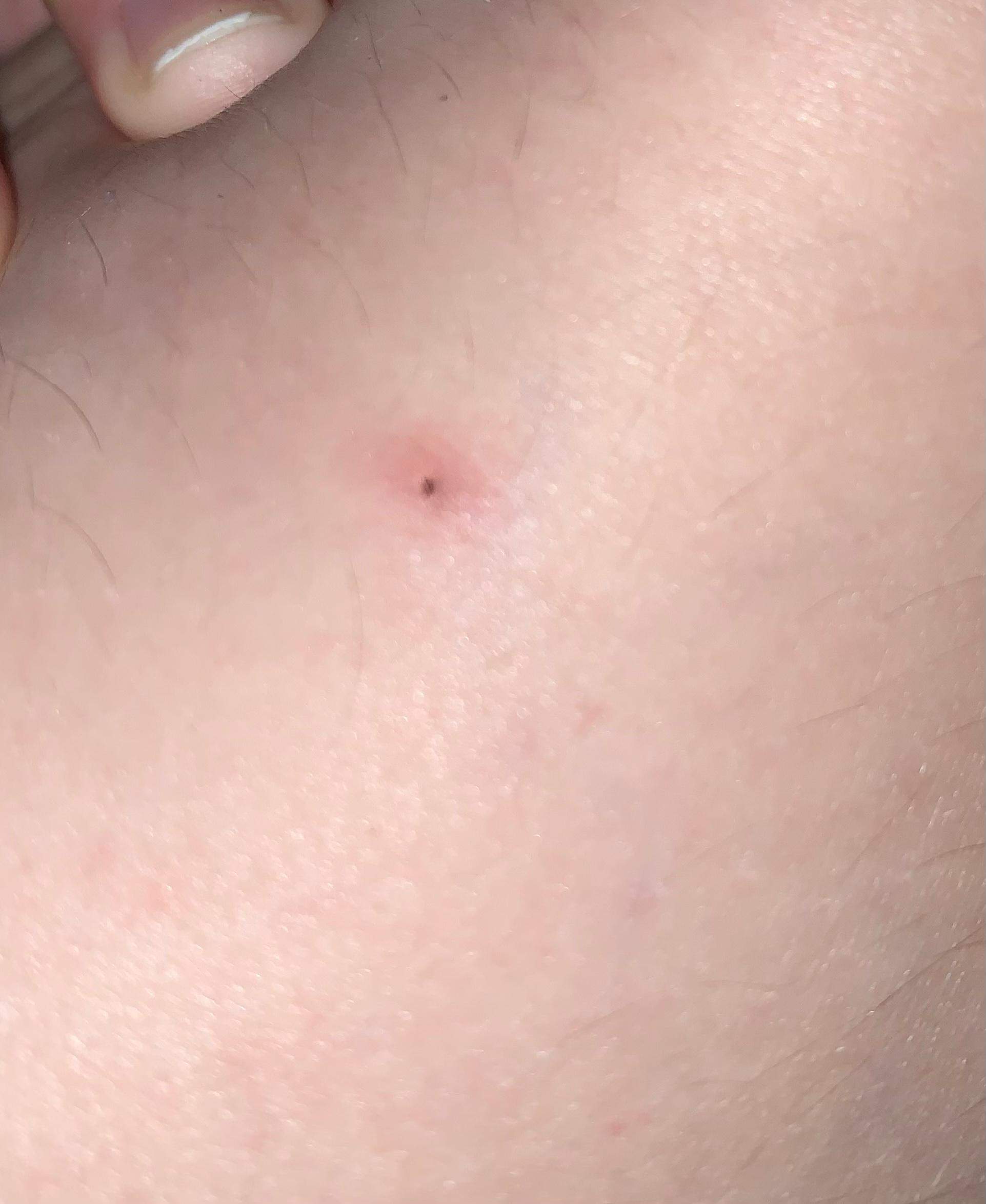 Fenerbahçe: Kopf Hoch, Fans! In Istanbul Ist Noch Alles Drin! - 998qkij