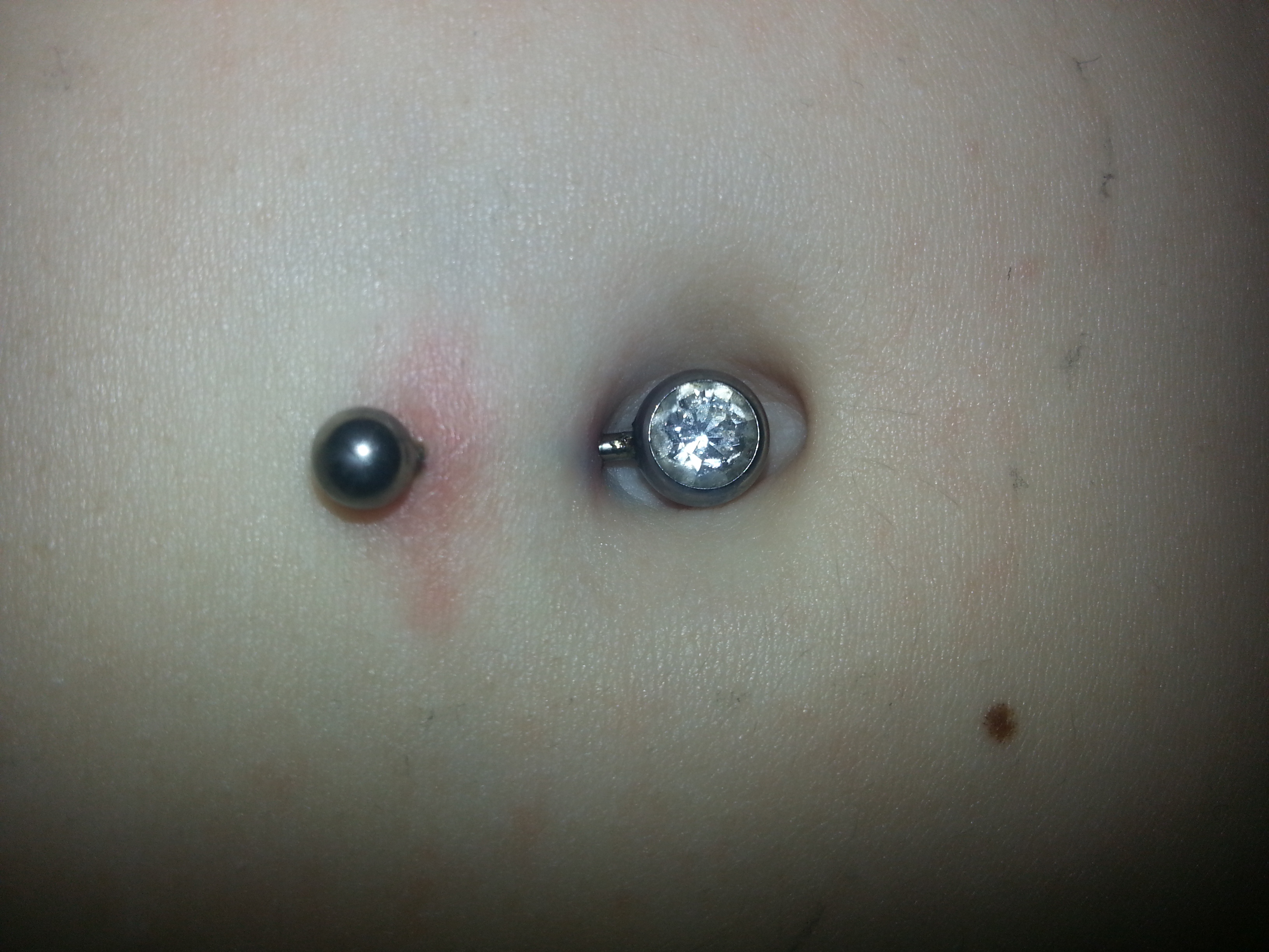 Wie Schnell Wächst Ein Bauchnabelpiercing Zu