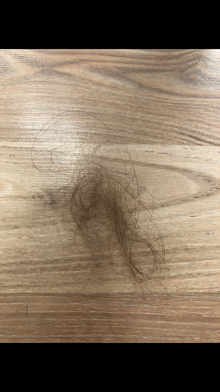 ist dieser haarausfall normal haare