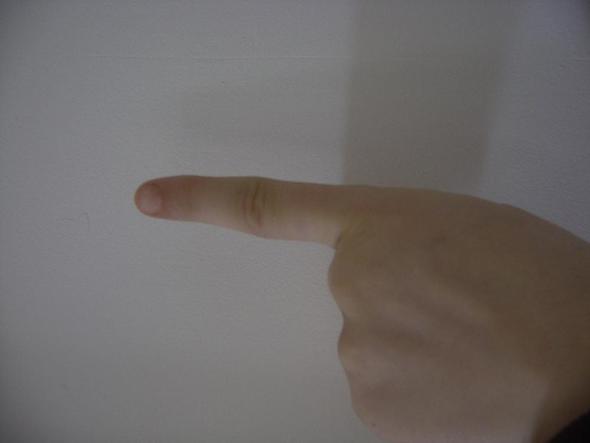 Der schiefe Zeigefinger - (Gesundheit, Körper, Schmerzen)