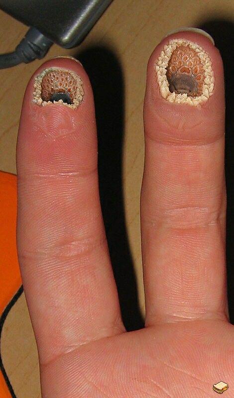 Ist dieses Foto echt und wenn ja was ist das? (Krankheit, krank, Finger)