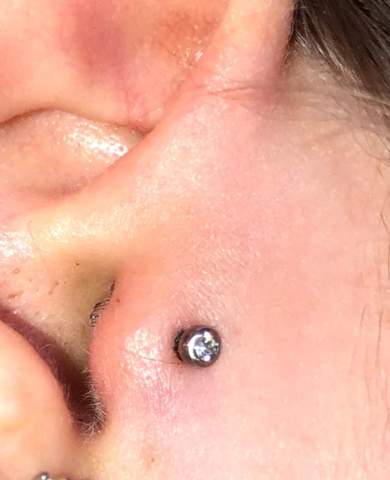 ist dieses tragus piercing entzundet gesundheit und medizin helix ohrknorpelpiercing
