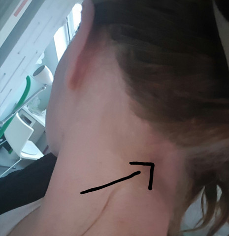 Ist Dort Ein Lymphknoten Und Wenn Nicht Was Kann Dort Sonst Anschwellen Medizin Angeschwollen Ist Dort Ein Lymphknoten Und Wenn Nicht Was Kann Dort Sonst Anschwellen Medizin Angeschwollen