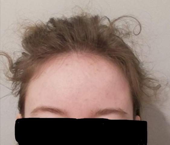 Ist Eine Hohe Stirn Schlimm Oder Wird Sie Noch Schlimmer Beauty Ist Eine Hohe Stirn Schlimm Oder Wird Sie Noch Schlimmer Beauty