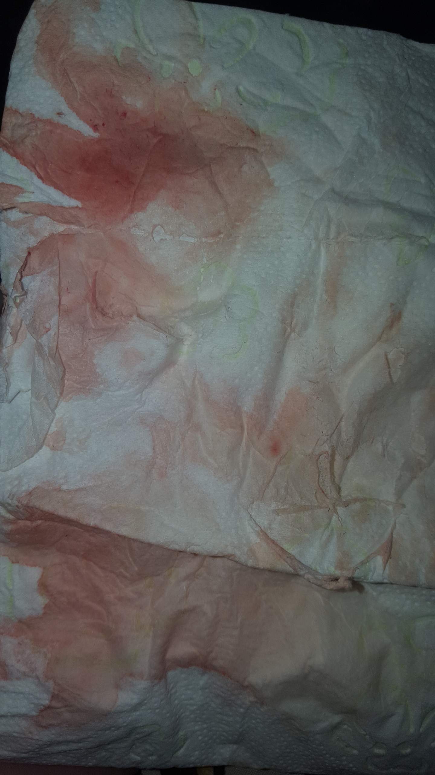 Ist Es Die Einnistung Schwangerschaft Periode Blutung Ist Es Die Einnistung Schwangerschaft Periode Blutung