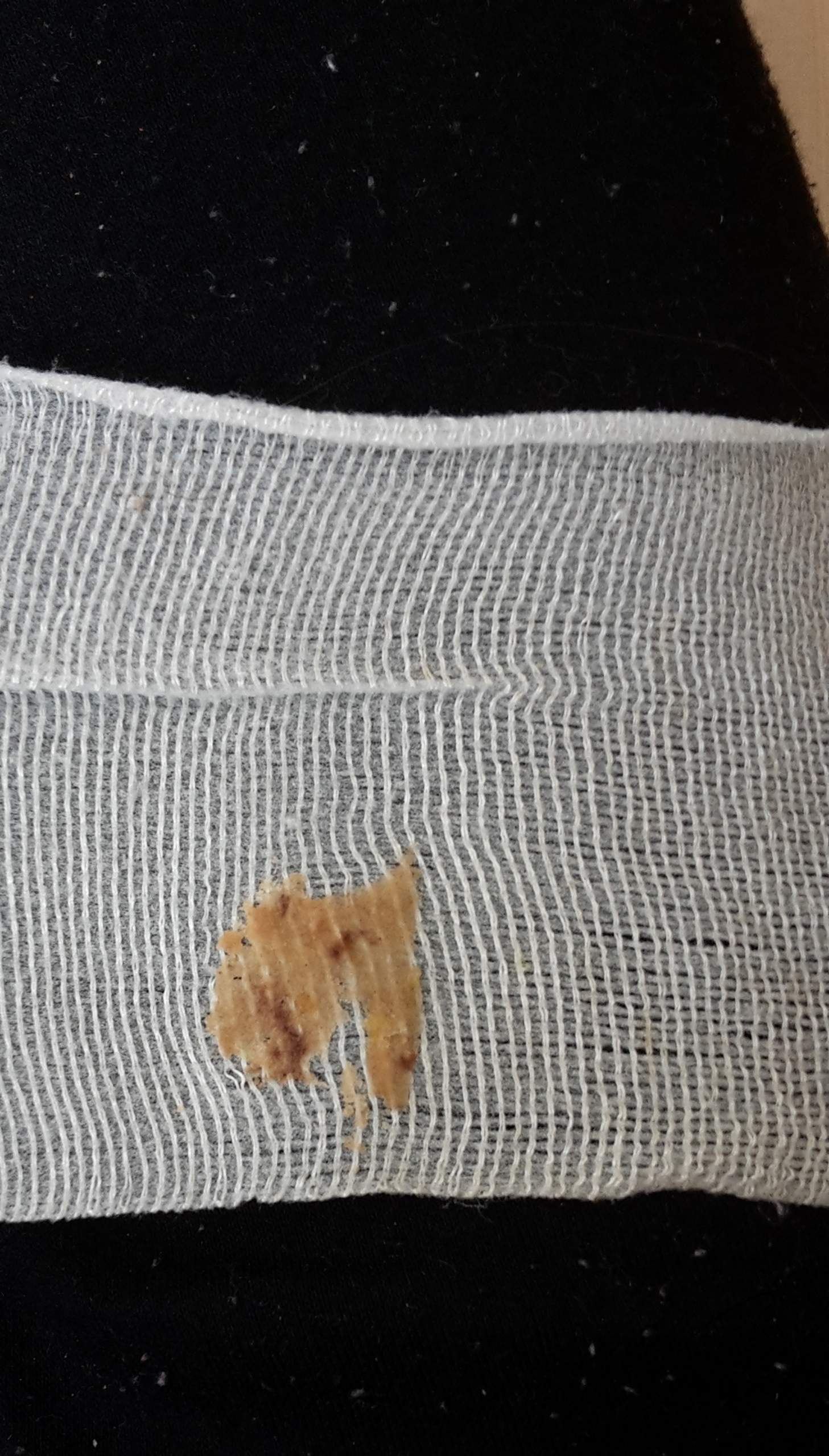 Ist es Eiter? (Arzt, Füße, Operation)