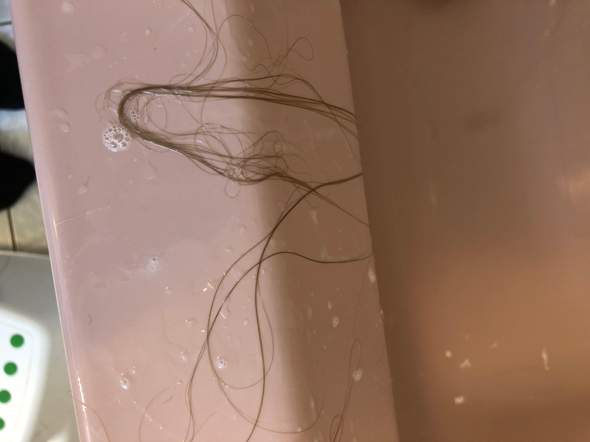 normal das mir so viele haare ausfallen