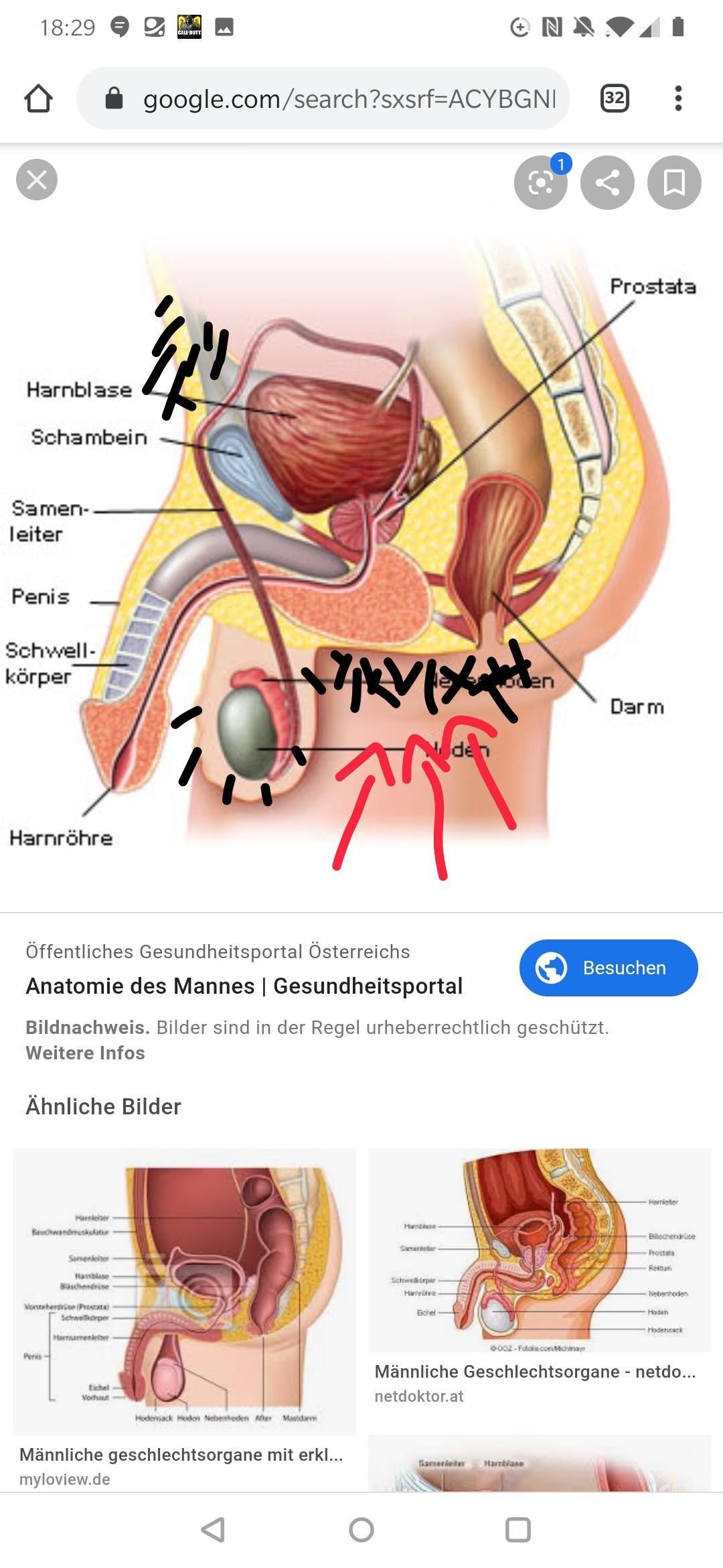 ist es normal dort extrem viele haare