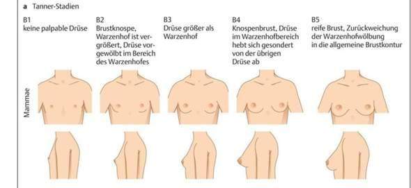Bild zum Beitrag