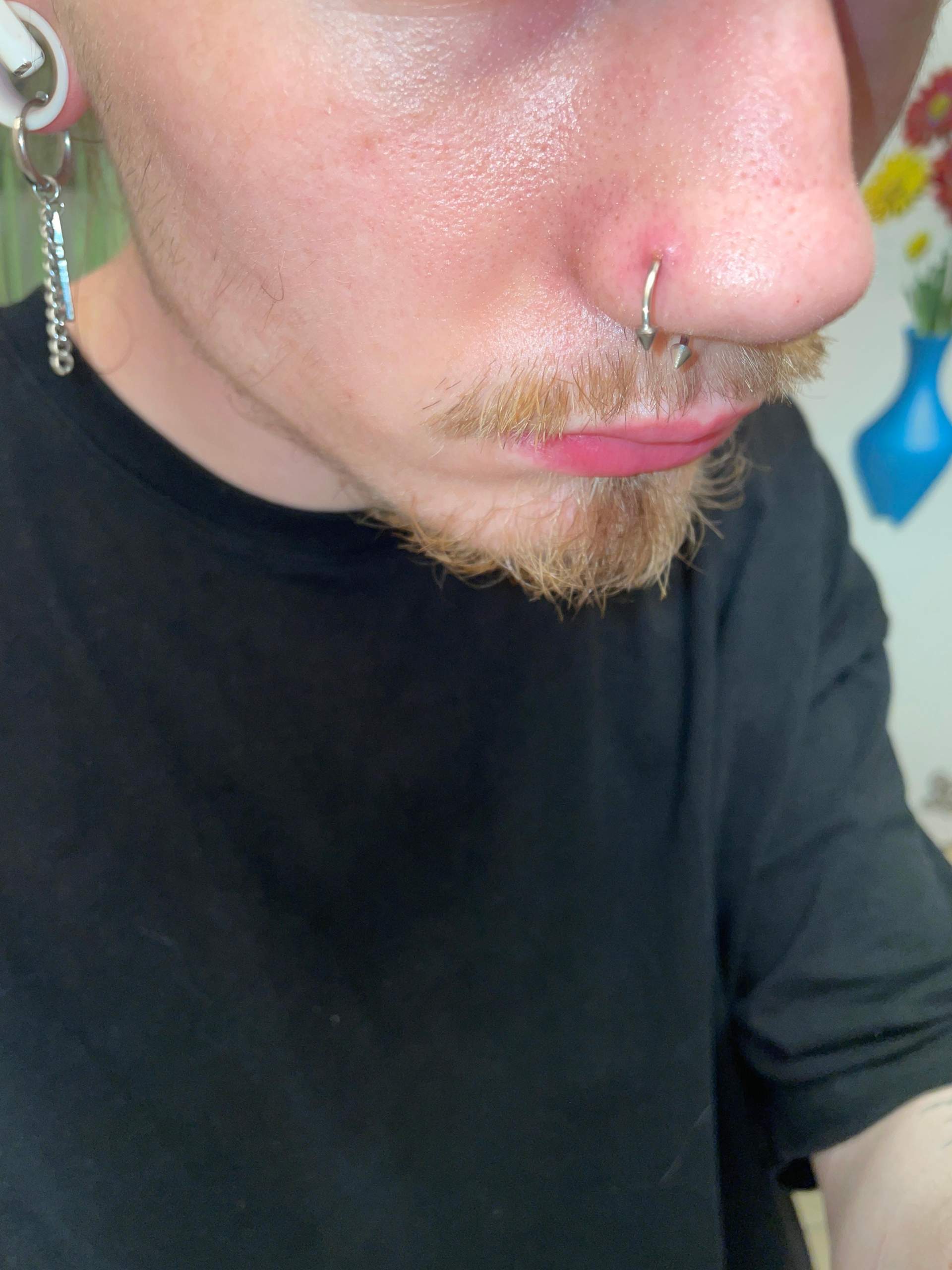 Ist es stark entzündet, wenn ja was sollte ich am besten tun? (Piercing