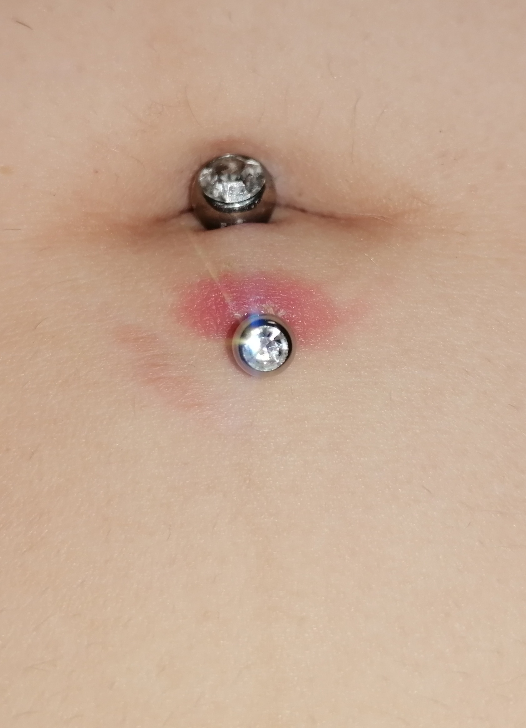 Ist mein Bauchnabel Piercing entzündet oder ist das normal ...