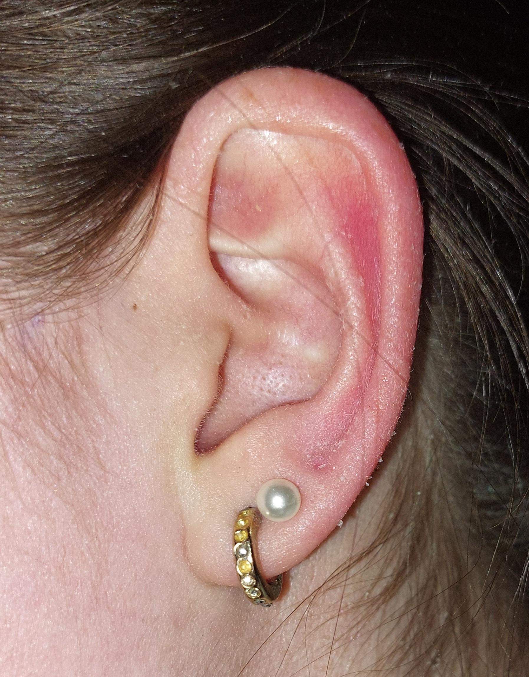 Ist mein drittes Ohrloch im Knorpel? (Piercing, Ohr, Ohrringe)