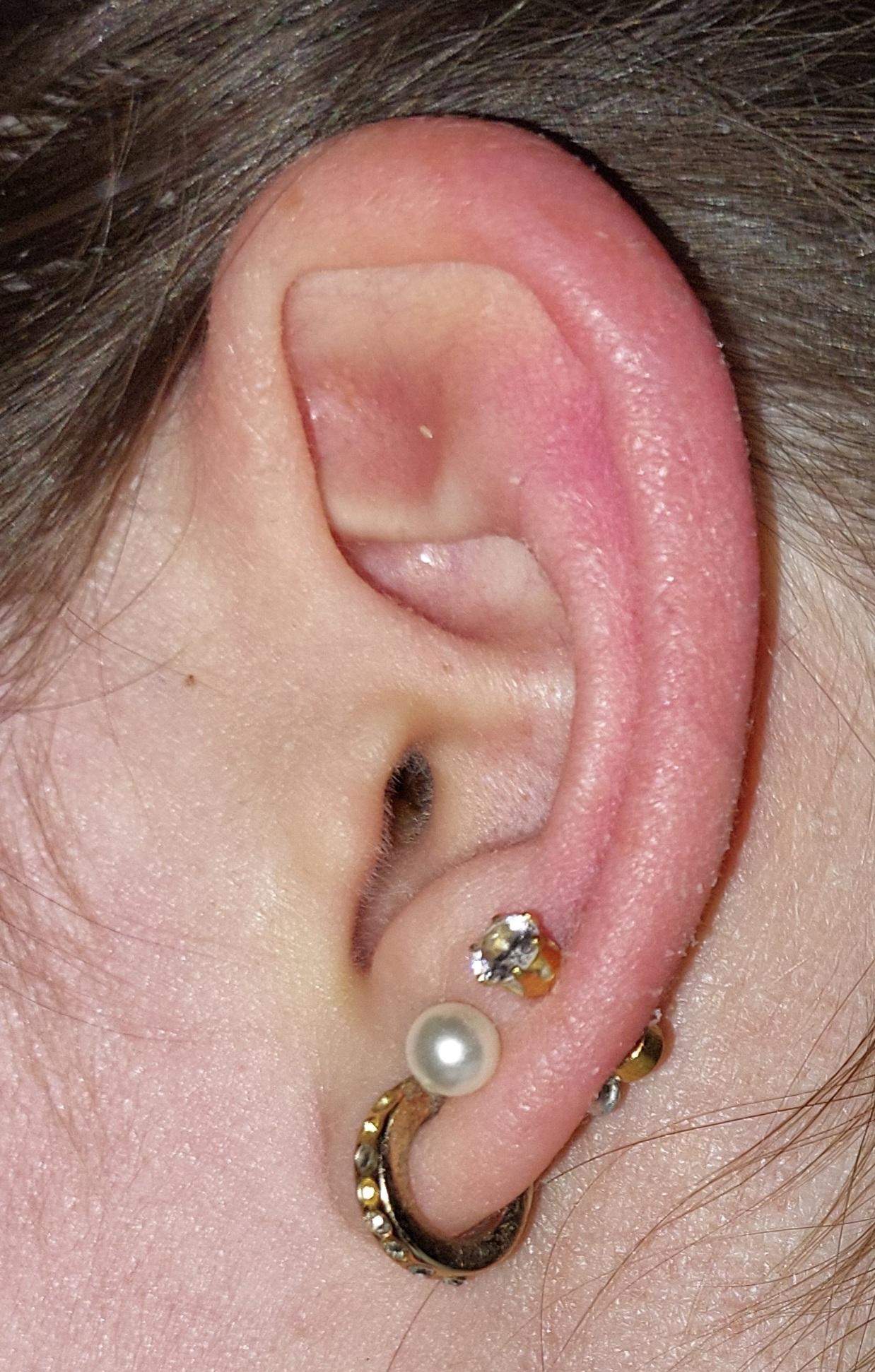 Ist mein drittes Ohrloch im Knorpel? (Piercing, Ohr, Ohrringe)