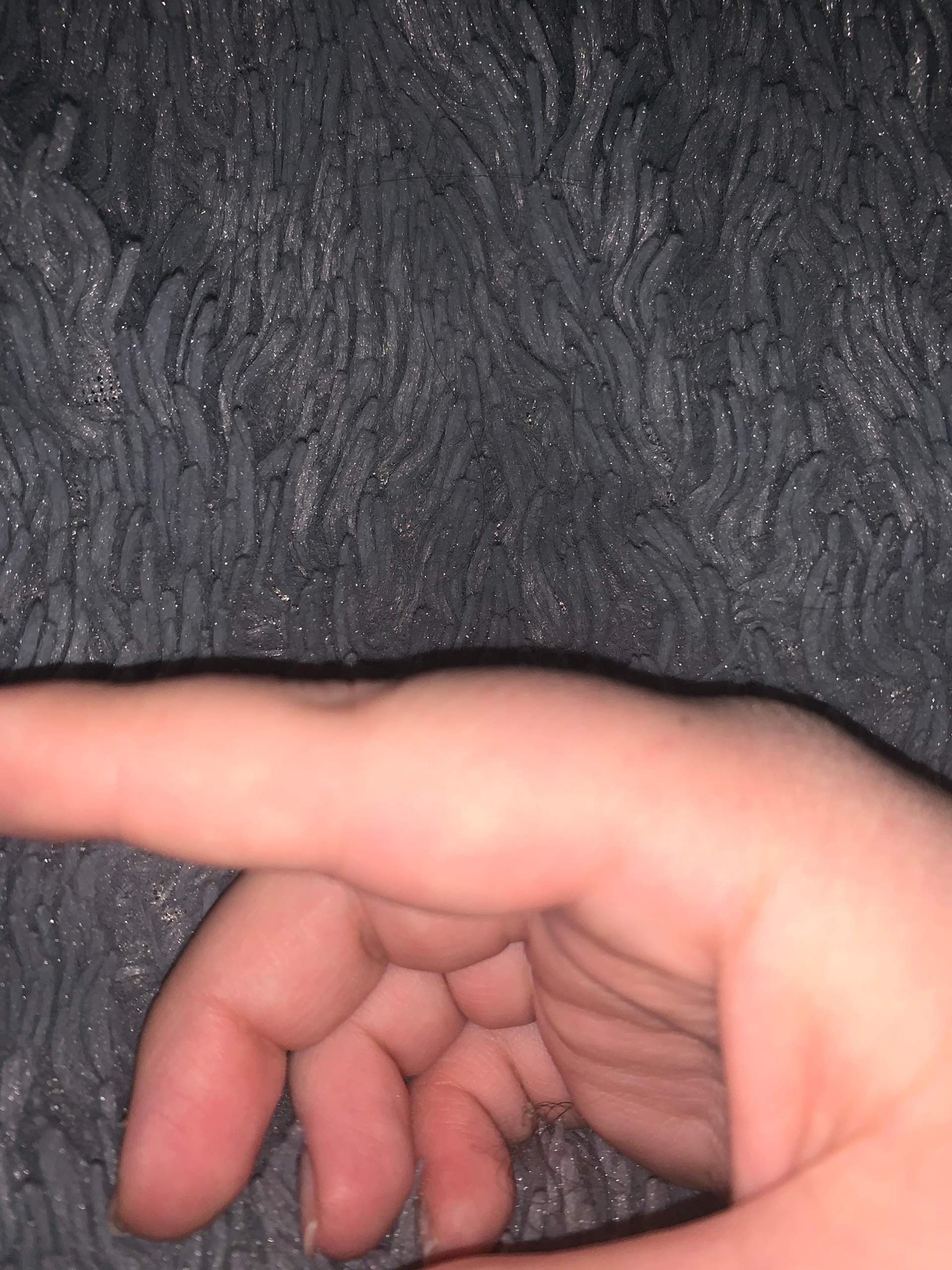 Ist mein Finger gebrochen? (Gesundheit und Medizin)