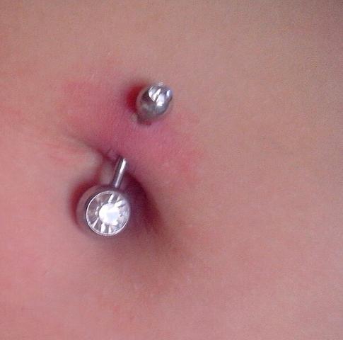 Bauchnabelpiercing entzündet was tun Bauchnabelpiercing entzündet was tun