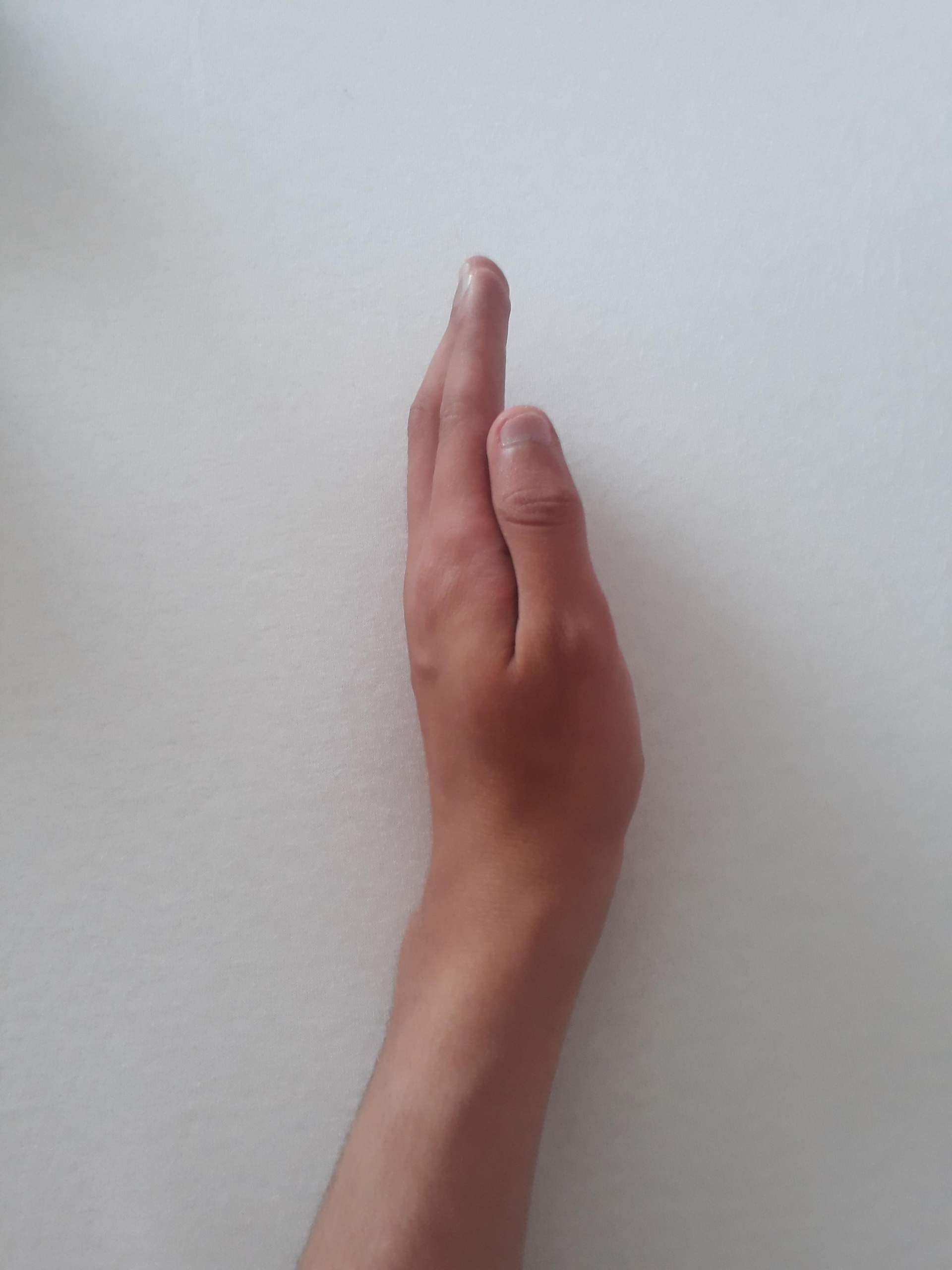Ist mein Handgelenk gebrochen bzw.geprellt? (Gesundheit und Medizin