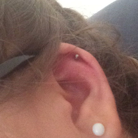 Ist Mein Helix Entzundet Oder Ist Das Normal Piercing Ohr Ist Mein Helix Entzundet Oder Ist Das Normal Piercing Ohr