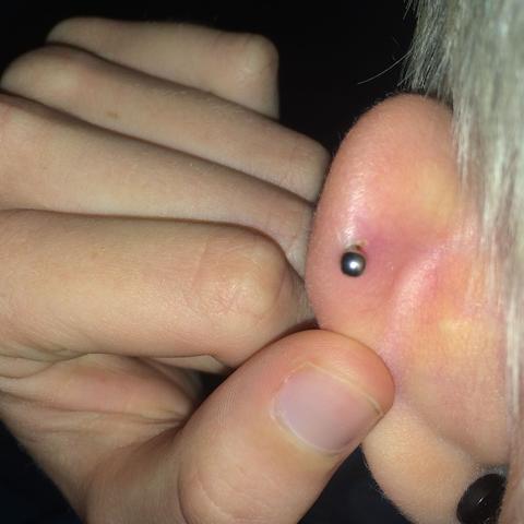 Entzündet ?  - (Helix, helix piercing)