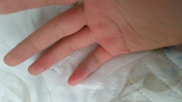 Finger brechen ohne schmerzen