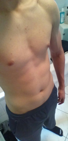 Ist mein Körper muskulös (15 Jahre alt)? (Fitness, Muskeln, Muskelaufbau)