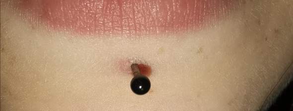 ist mein labret piercing entzundet gesundheit und medizin