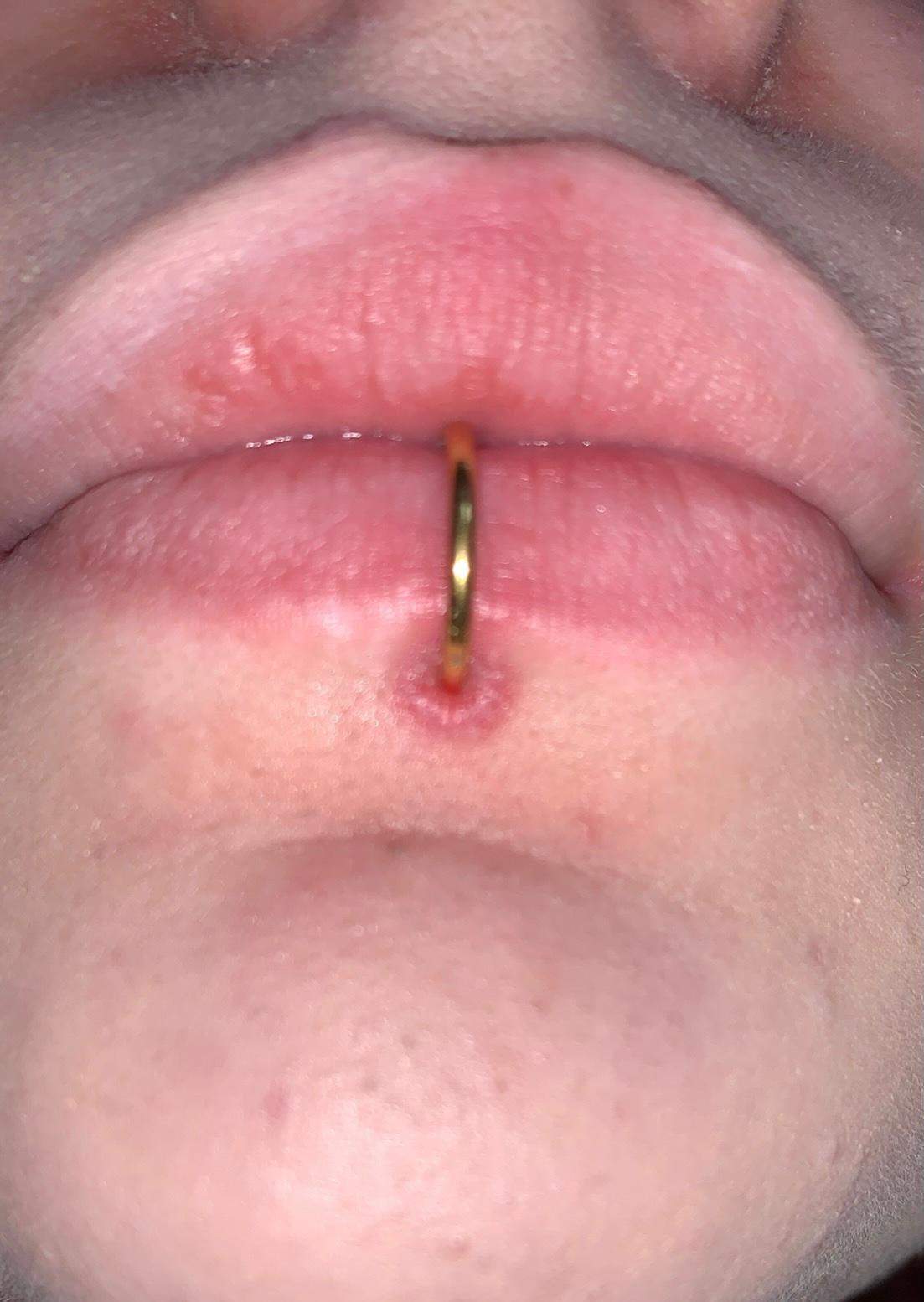 ist mein labret piercing entzundet