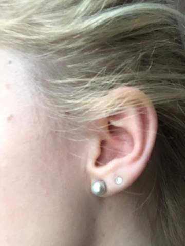 Ist mein Ohr zu klein für ein Tragus Piercing?