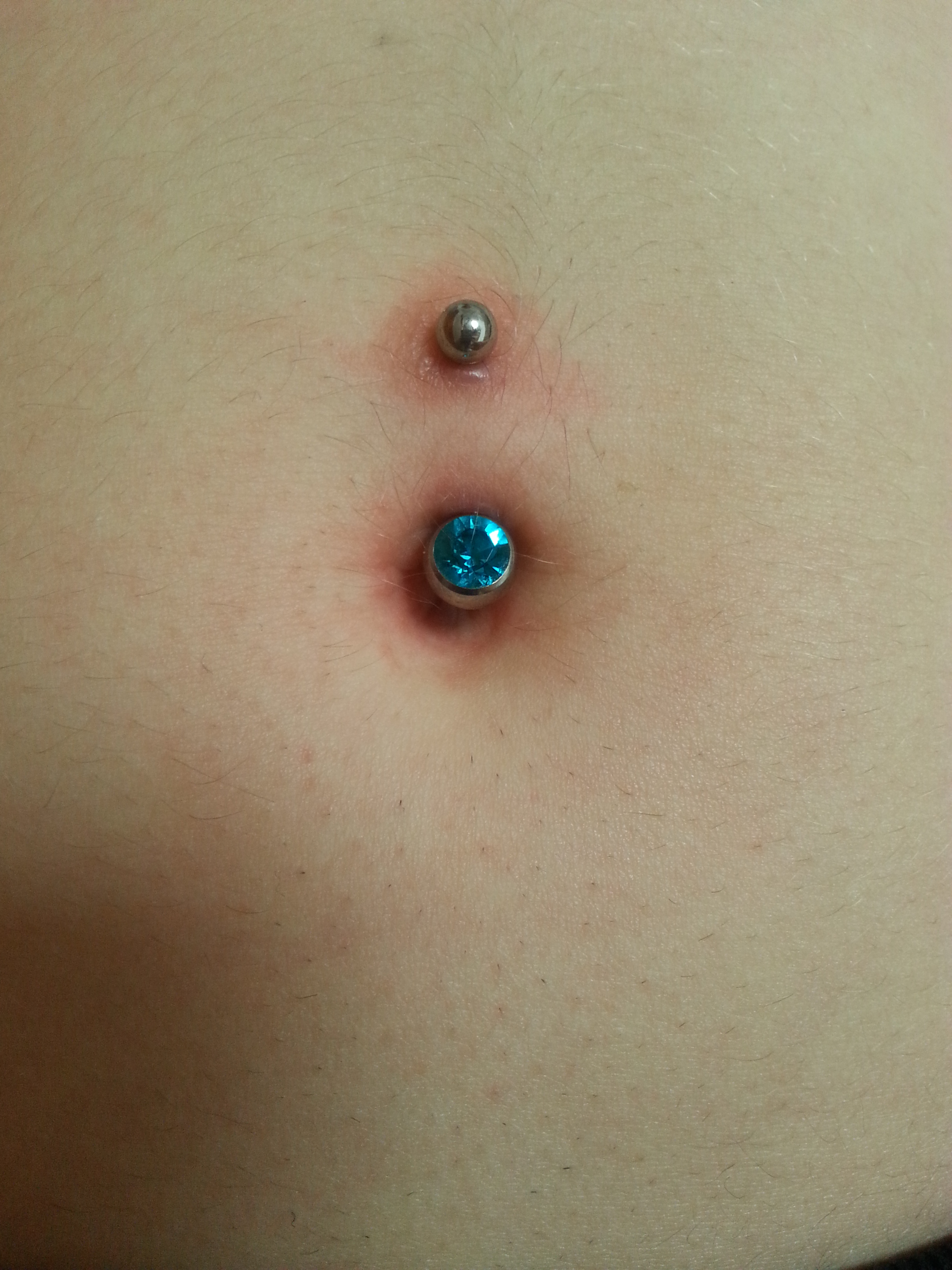 Was Tun Gegen Wildfleisch Am Bauchnabelpiercing