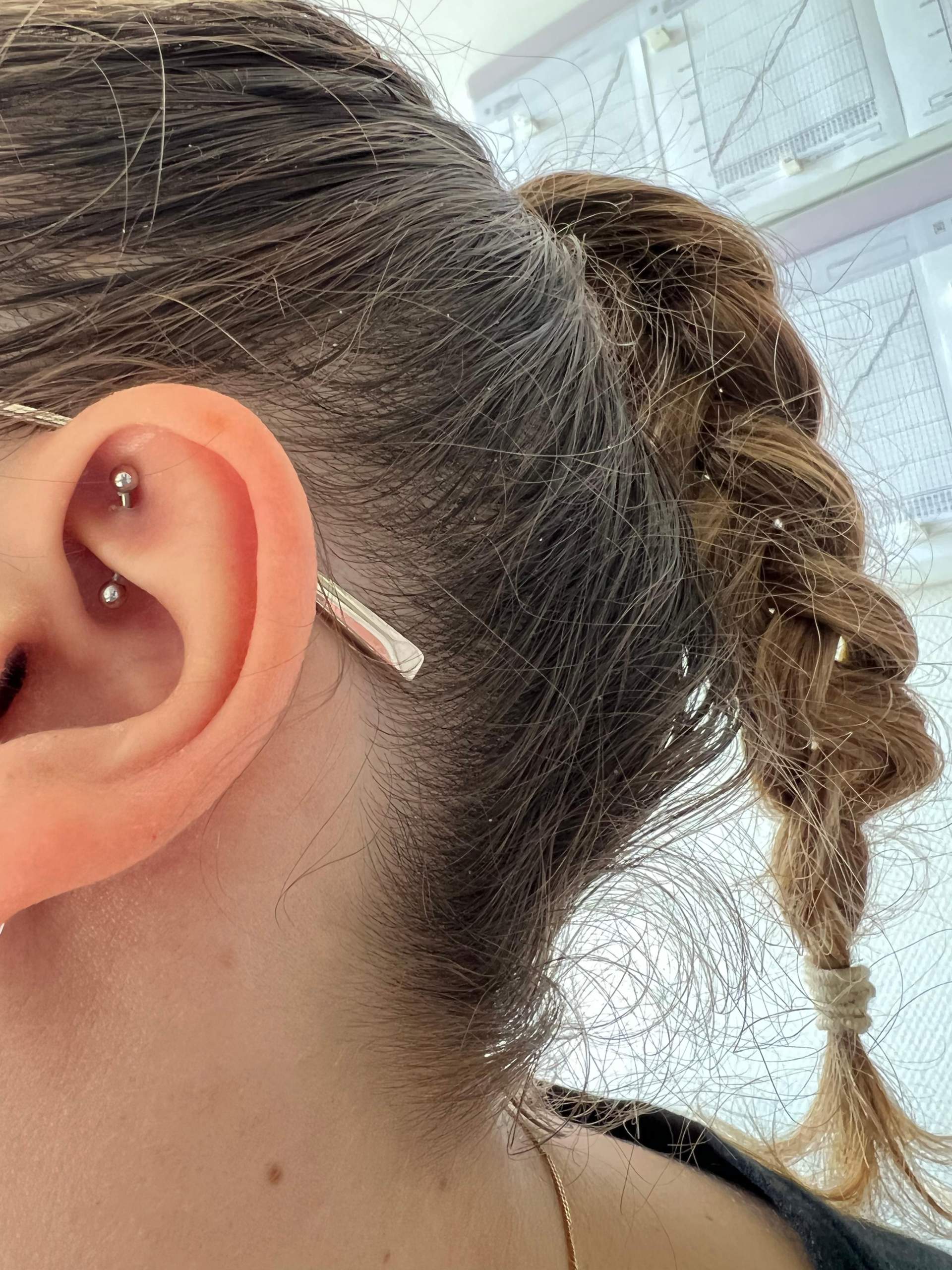 Ist mein Rook entzündet? (Piercing, Entzündung, Piercer)