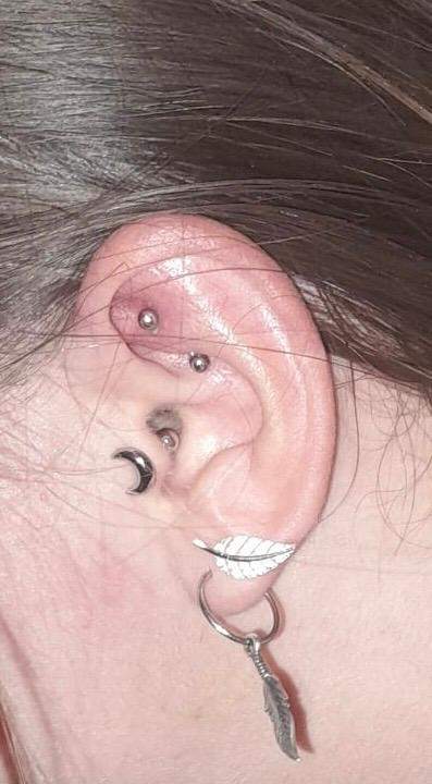 Ist mein Rook Piercing entzündet es ist leicht rot? (Entzündung)