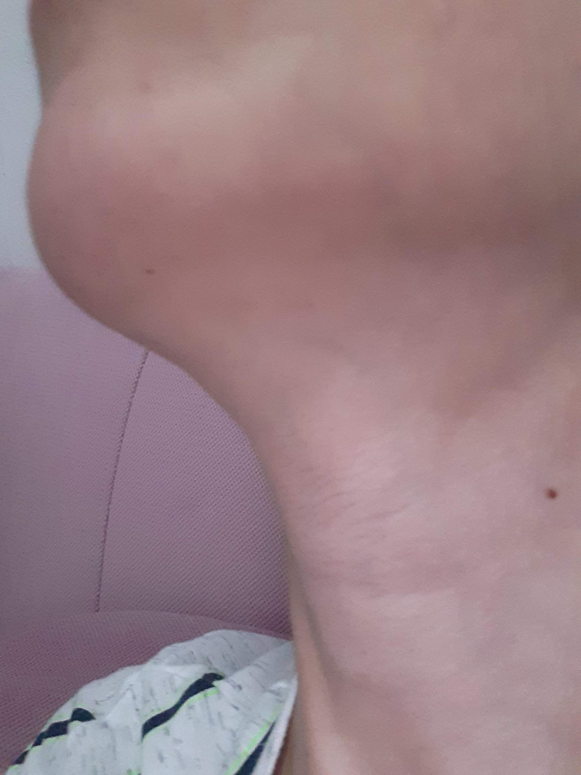 Ist Mein Schilddrusse Gross Oder Normal Gesundheit Pubertat Schilddruse Ist Mein Schilddrusse Gross Oder Normal Gesundheit Pubertat Schilddruse