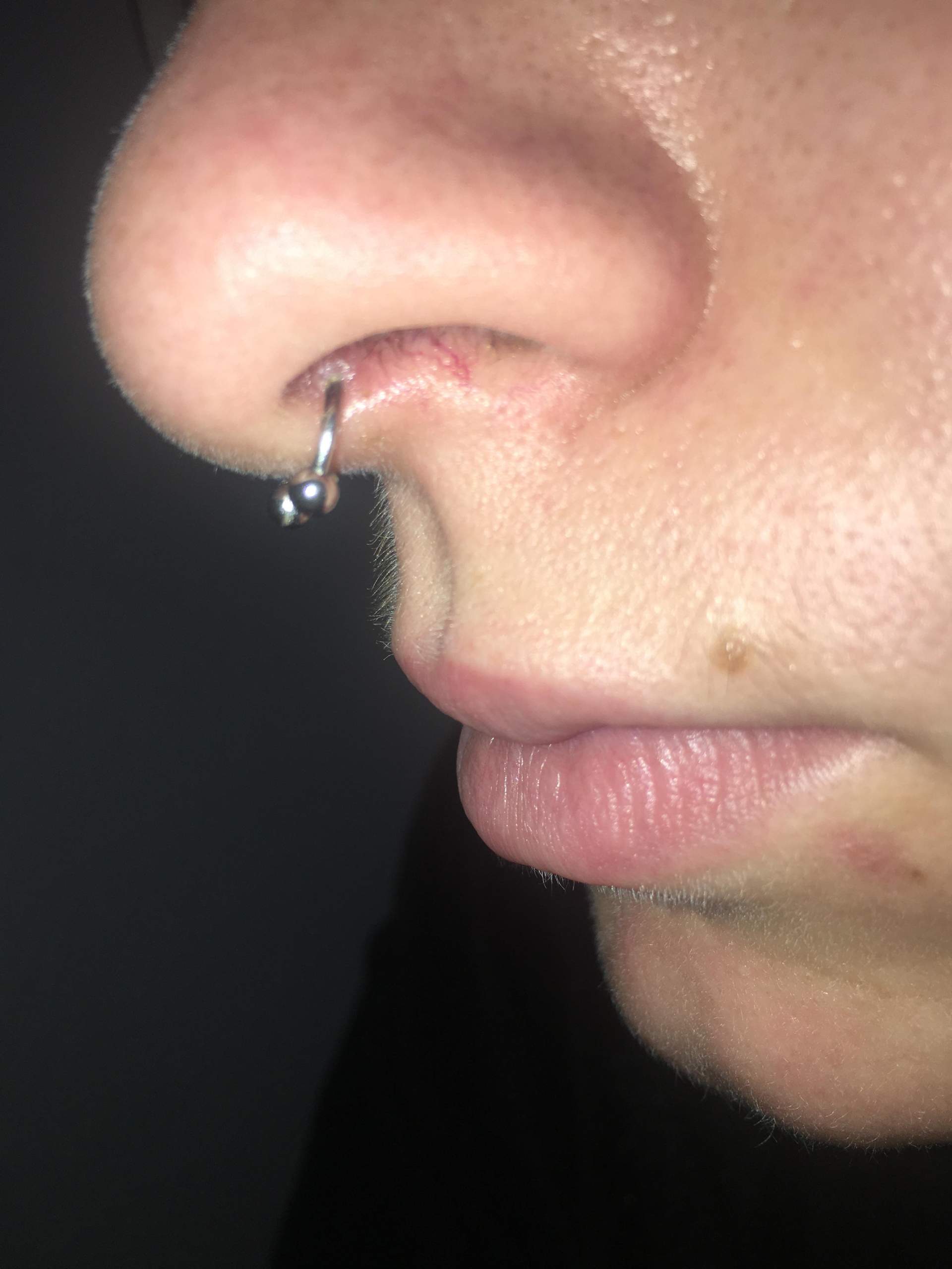 Ist mein Septum falsch gestochen? (Gesundheit und Medizin, Piercing