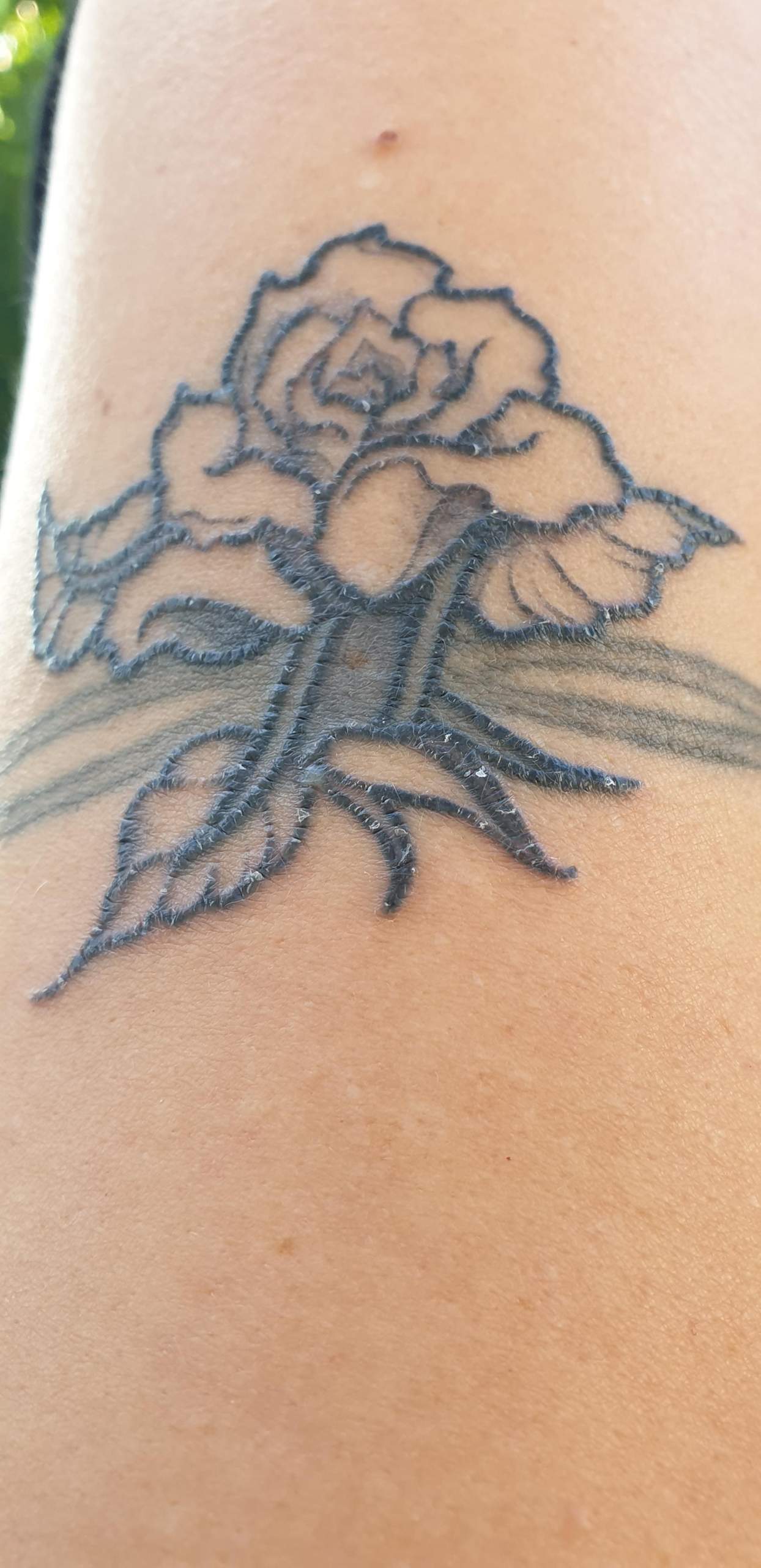 Wieso Vernarbt Ein Tattoos
